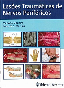 Livro Lesoes Traumaticas de Nervos Perifericos - Siqueira