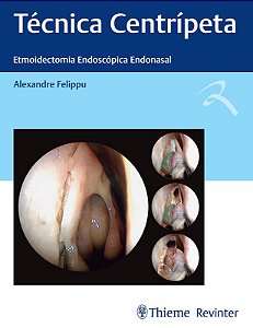 Livro Técnica Centripeta: Etmoidectomia Endoscópica Endonasal - Felippu - Revinter
