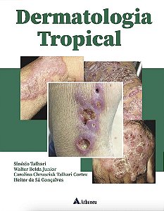 Livro Dermatologia Tropical - Talhari/belda Junior
