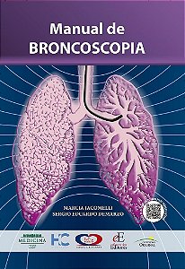 Livro Manual De Broncoscopia FMUSP