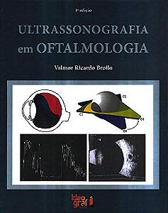 Livro Ultrassonografia em Oftalmologia