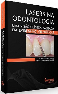Livro Lasers Na Odontologia: Uma Visão Clínica Baseada em Evidências Cientiíicas