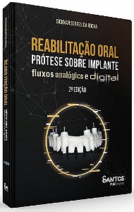 Livro Reabilitação Oral: Prótese sobre Implante Fluxos Analógico e Digital