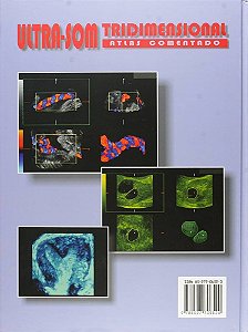 Livro Ultra-som Tridimensional - Atlas Comentado - Montenegro