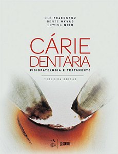 Livro Cárie Dentária: Fisiopatologia e Tratamento: Fejerskov