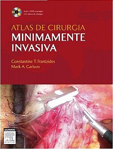Livro Atlas de Cirurgia Minimamente Invasiva - Frantzides