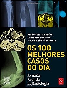 Livro Os 100 Melhores Casos do Dia - Rocha