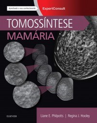 Livro Tomossintese Mamaria - Philpotts