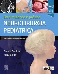 Livro Neurocirurgia Pediátrica