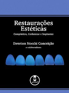 Livro Restauracoes Esteticas Compositos, Ceramicas e Implantes - Conceicao