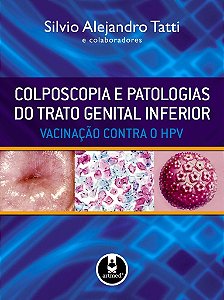 Livro Colposcopia e Patologias do Trato Genital Inferior