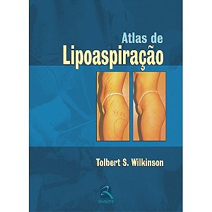 Livro Atlas de Lipoaspiração - Wilkinson