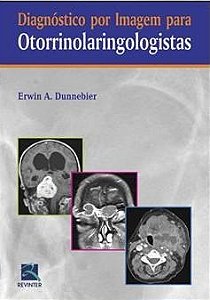 Livro Diagnostico por Imagem para Otorrinolaringologistas - Dunnebier
