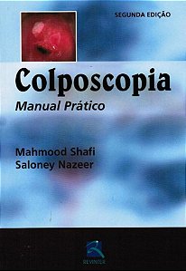 Livro Colposcopia Manual Prático