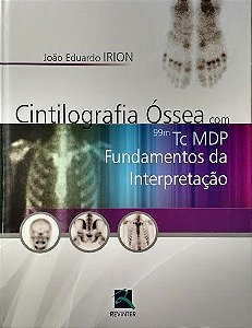 Livro Cintilografia Óssea com 99m TC MDP - Irion