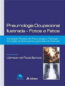 Livro Pneumologia Ocupacional Ilustrada-fotos e Fatos SPPT
