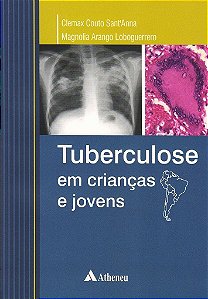Livro Tuberculose em Crianças e Jovens