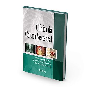 Livro Clínica da Coluna Vertebral - Martins - Atheneu