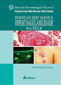 Livro Doencas dos Vasos e Hipercoabilidade Na Pele - Vol.3 - Serie: Dermatologica - Criado