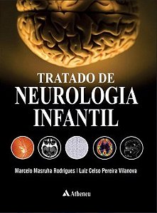Livro Tratado de Neurologia Infantil