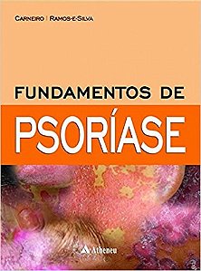 Livro Fundamentos de Psoriase - Carneiro/ramos-e-sil