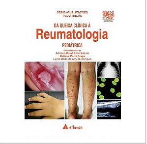 Livro Da Queixa Clínica a Reumatologia Pediátrica