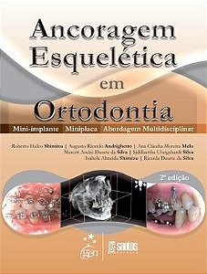 Livro Ancoragem Esquelética em Ortodontia: Mini-implante, Miniplaca