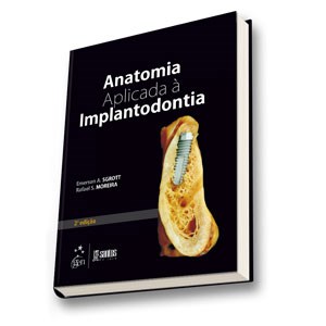 Livro Anatomia Aplicada a Implantodontia - Sgrott / Moreira