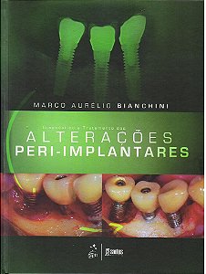Livro Diagnóstico e Tratamento das Alterações Peri - Implantares - Bianchini - Santos