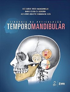 Livro Cirurgia da Articulação Temporomandibular  Manganello