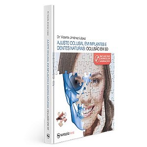 Livro Ajuste Oclusal em Implantes e Dentes Naturais: Oclusão em 3d