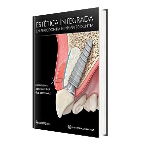 Livro Estética Integrada em Periodontia e Implantodontia - Frizzera - Napoleão