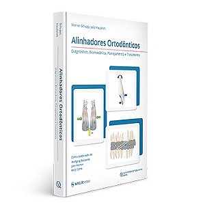 Livro Alinhadores Ortodonticos: Diagnostico, Biomecanica, Planejamento e Tratamen - Schupp/haubrich