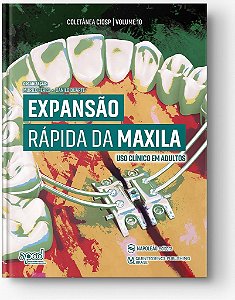 Livro Expansao Rapida da Maxila: Uso Clinico em Adulto - Feres/duarte