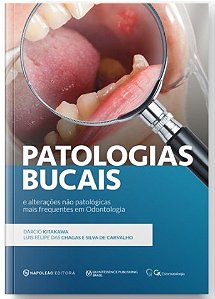 Livro Patologias Bucais e Alterações Não Patológicas Mais Frequentes em Odontologia - Kitakawa