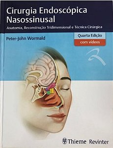 Livro Cirurgia Endoscopica Nasossinusal - Wormald