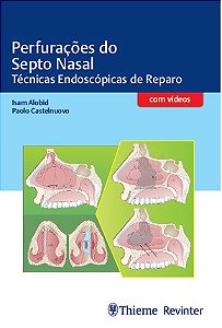 Livro Perfuracoes do Septo Nasal - Tecnicas Endoscopicas de Reparo - Alobid/castelnuovo