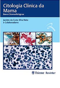 Livro Citologia Clínica da Mama - Silva Neto