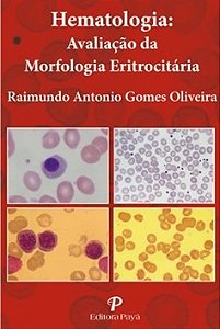Livro Hematologia Avaliação da Morfologia Eritrocitária: Pranchas