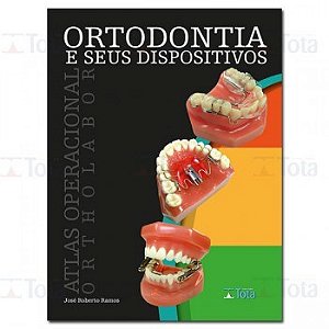Livro Ortodontia e Seus Dispositivos: Atlas Operacional Ortholabor