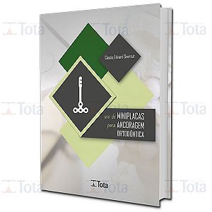 Livro Uso De Miniplacas Para Ancoragem Ortodôntica - Sverzut - Tota