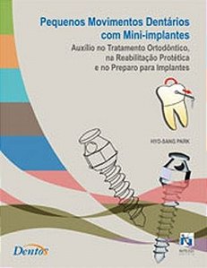 Livro Pequenos Movimentos Dentários com Mini-implantes - Park - Napoleão