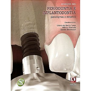 Livro Avanços em Periodontia e Implantodontia - Tunes - Napoleão