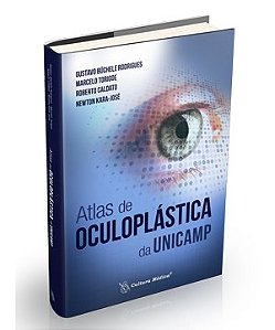 Livro Atlas de Oculoplástica da UNICAMP - Rodrigues