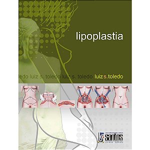 Livro Lipoplastia - Toledo