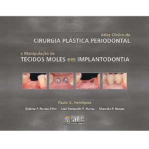Livro Atlas Clínico de Cirurgia Plástica Periodontal