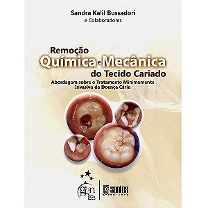 Livro Remoção Química: Mecânica da Carie  Bussadori