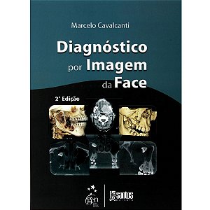 Livro Diagnóstico por Imagem da Face: Cavalcanti