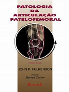 Livro Patologia da Articulacao Patelofemoral - Fulkerson