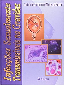 Livro Infeccoes Sexualmente Transmissiveis Na Gravidez - Porto